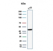 Western blot testing of human Y79 cell lysate with recombinant CKBB antibody. Predicted molecular weight ~43 kDa.