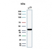 Western blot testing of human Y79 cell lysate with recombinant Brain Creatine Kinase antibody (clone CKBB/8310R). Predicted molecular weight ~43 kDa.