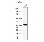Western blot testing of human Y79 cell lysate with Creatine kinase B antibody (clone CKBB/8608R). Predicted molecular weight ~43 kDa.