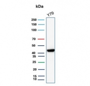 Western blot testing of human Y79 cell lysate with Brain Creatine Kinase antibody (clone CKBB/8843R). Predicted molecular weight ~43 kDa.