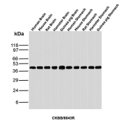 Western blot analysis of Human Brain, Mouse Brain, Rat Brain, Hamster Brain, Guinea pig Brain, Human Stomach, Mouse Stomach, Rat Stomach, Hamster Stomach and Guinea pig Stomach tissue lysates using Brain Creatine Kinase antibody (clone CKBB/8843R). Predicted molecular weight ~43 kDa.
