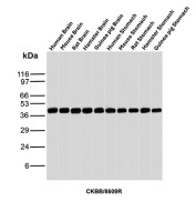 Western blot analysis of Human Brain, Mouse Brain, Rat Brain, Hamster Brain, Guinea pig Brain, Human Stomach, Mouse Stomach, Rat Stomach, Hamster Stomach and Guinea pig Stomach tissue lysates using Creatine phosphokinase BB antibody (clone CKBB/8609R). Predicted molecular weight ~43 kDa.