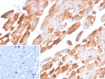 IHC staining of FFPE human heart tissue with Tropomyosin antibody (clone TPM1/4510). Inset: PBS used in place of primary Ab (secondary Ab negative control). HIER: boil tissue sections in pH 9 10mM Tris with 1mM EDTA for 20 min and allow to cool before testing.