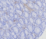 IHC staining of FFPE human stomach (corpus) with BCMA antibody (clone CD269/8125R). HIER: boil tissue sections in pH 9 10mM Tris with 1mM EDTA for 20 min and allow to cool before testing.