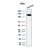 Western blot testing of human kidney tissue lysate with Cadherin 16 antibody. Expected molecular weight: 90~130 kDa.