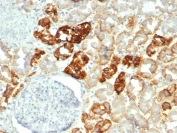 IHC staining of FFPE human kidney tissue with Cadherin 16 antibody (clone CDH16/2449). HIER: boil tissue sections in pH 9 10mM Tris with 1mM EDTA for 20 min and allow to cool before testing.