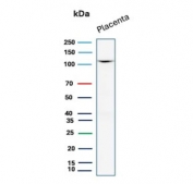 Western blot testing of human placental tissue lysate with recombinant CDH1 antibody. Expected molecular weight: 135 kDa (precursor), 80-120 kDa (mature, depending on glycosylation level).