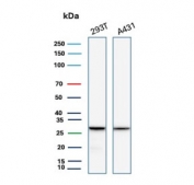 Western blot testing of human 293T and A431 cell lysate with recombinant YWHAE antibody. Predicted molecular weight ~28 kDa.