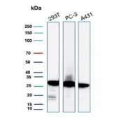 Western blot testing of human 293T, PC-3 and A431 cell lysate with recombinant 14-3-3E antibody. Predicted molecular weight ~28 kDa.