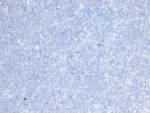 Negative control: IHC testing of FFPE human brain tissue with ErbB2 antibody (clone ERBB2/6637) at 2ug/ml. HIER: boil tissue sections in pH 9 10mM Tris with 1mM EDTA for 20 min and allow to cool before testing.