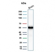Western blot testing of human brain tissue with GFAP antibody. Predicted molecular weight ~50 kDa.