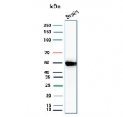 Western blot testing of human brain tissue with Glial Fibrillary Acidic Protein antibody. Predicted molecular weight ~50 kDa.