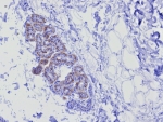 IHC staining of FFPE human skin tissue with recombinant Keratin 17 antibody (clone KRT17/8346R). HIER: boil tissue sections in pH 9 10mM Tris with 1mM EDTA for 20 min and allow to cool before testing.