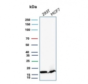 Western blot testing of human 293T and MCF-7 cell lysate with NME2 antibody (clone NME2/6435). Predicted molecular weight ~17 kDa.