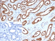 IHC staining of FFPE human kidney tissue with NDKB antibody (clone NME2/6437). Inset: PBS used in place of primary Ab (secondary Ab negative control). HIER: boil tissue sections in pH 9 10mM Tris with 1mM EDTA for 20 min and allow to cool before testing.