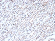 IHC staining of FFPE human heart tissue with Cadherin 2 antibody (clone CDH2/8862R). HIER: boil tissue sections in pH 9 10mM Tris with 1mM EDTA for 20 min and allow to cool before testing.