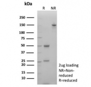 SDS-PAGE analysis of purified, BSA-free N-Cadherin antibody (clone CDH2/8998R) as confirmation of integrity and purity.