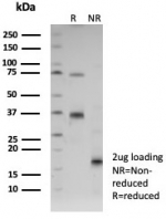 SDS-PAGE analysis of purified, BSA-free CD31 antibody (clone C31/8592R) as confirmation of integrity and purity.