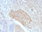 IHC staining of FFPE human testis tissue with recombinant Survivin antibody (clone BIRC5/8936R). Inset: PBS used in place of primary Ab (secondary Ab negative control). HIER: boil tissue sections in pH 9 10mM Tris with 1mM EDTA for 20 min and allow to cool before testing.
