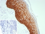 IHC staining of FFPE human skin tissue with Desmoglein 3 antibody (clone DSG3/8613R). Inset: PBS used in place of primary Ab (secondary Ab negative control). HIER: boil tissue sections in pH 9 10mM Tris with 1mM EDTA for 20 min and allow to cool before testing.