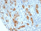 IHC staining of FFPE human lung tissue with SERPINB5 antibody (clone SERPINB5/4971). HIER: boil tissue sections in pH 9 10mM Tris with 1mM EDTA for 20 min and allow to cool before testing.