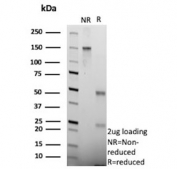 SDS-PAGE analysis of purified, BSA-free CNN1 antibody (clone rCNN1/6918) as confirmation of integrity and purity.