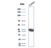 Western blot testing of human colon tissue lysate with CNN1 antibody. Predicted molecular weight ~34 kDa.