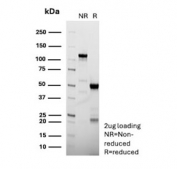 SDS-PAGE analysis of purified, BSA-free Calponin 1 antibody (clone CNN1/8870R) as confirmation of integrity and purity.