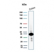 Western blot testing of human colon tissue lysate with Calponin 1 antibody. Predicted molecular weight ~34 kDa.
