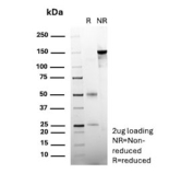 SDS-PAGE analysis of purified, BSA-free BRAF antibody (clone BRAF/1626) as confirmation of integrity and purity.