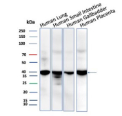 Western blot testing of human 1) lung, 2) small intestine, 3) gallbladder and 4) placenta tissue lysate with BRAF antibody (clone BRAF/1626). Predicted molecular weight ~36 kDa.