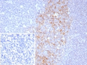 IHC staining of FFPE human tonsil tissue with CD23 antibody (clone FCER2/8511R). Inset: PBS used in place of primary Ab (secondary Ab negative control). HIER: boil tissue sections in pH 9 10mM Tris with 1mM EDTA for 20 min and allow to cool before testing.