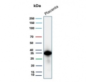 Western blot testing of human placental tissue lysate with EBI3 antibody (clone EBI3/8903). Predicted molecular weight ~25 kDa but may be observed at higher molecular weights due to glycosylation.