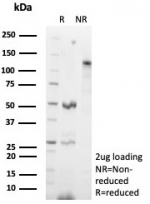 SDS-PAGE analysis of purified, BSA-free recombinant CD54 antibody (clone ICAM1/8677R) as confirmation of integrity and purity.