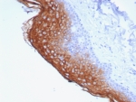 IHC staining of FFPE human skin tissue with Suprabasin antibody (clone SBSN/7964). HIER: boil tissue sections in pH 9 10mM Tris with 1mM EDTA for 20 min and allow to cool before testing.
