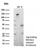 SDS-PAGE analysis of purified, BSA-free KLK5 antibody (clone KLK5/4761) as confirmation of integrity and purity.