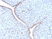 IHC staining of FFPE human bladder tissue with Uroplakin 3B antibody (clone UPK3B/8550R). HIER: boil tissue sections in pH 9 10mM Tris with 1mM EDTA for 20 min and allow to cool before testing.