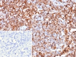 IHC staining of FFPE human lymph node tissue with Guanylate binding protein 1 antibody (clone GBP1/7617). Inset: PBS used in place of primary Ab (secondary Ab negative control). HIER: boil tissue sections in pH 9 10mM Tris with 1mM EDTA for 20 min and allow to cool before testing.