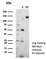 SDS-PAGE analysis of purified, BSA-free Mitotic centromere associated kinesin antibody (clone KIF2C/6523) as confirmation of integrity and purity.