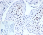 IHC staining of FFPE human testis tissue with Mitotic centromere associated kinesin antibody (clone KIF2C/6523) at 2ug/ml. Inset: PBS used in place of primary Ab (secondary Ab negative control). HIER: boil tissue sections in pH 9 10mM Tris with 1mM EDTA for 20 min and allow to cool before testing.