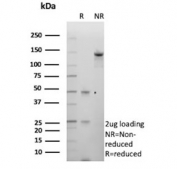 SDS-PAGE analysis of purified, BSA-free Kinesin Family Member 2C antibody (clone KIF2C/4707) as confirmation of integrity and purity.