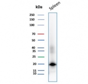 Western blot testing of human spleen tissue lysate with Stathmin 1 antibody. Expected molecular weight ~17 kDa. 