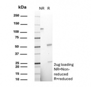 SDS-PAGE analysis of purified, BSA-free recombinant CD48 antibody (clone CD48/8360R) as confirmation of integrity and purity.