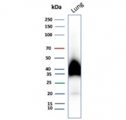 Western blot testing of human lung tissue lysate with Gp36 antibody. Predicted molecular weight ~25 kDa but may be observed at higher molecular weights due to glycosylation.
