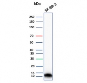Western blot testing of human SK-BR-3 cell lysate with S100A16 antibody. Predicted molecular weight ~12 kDa.