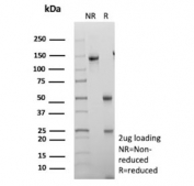 SDS-PAGE analysis of purified, BSA-free S100A16 antibody (clone S100A16/7412) as confirmation of integrity and purity.