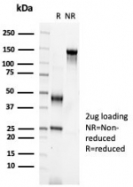 SDS-PAGE analysis of purified, BSA-free S100A2 antibody (clone S100A2/6925) as confirmation of integrity and purity.