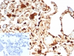 IHC staining of FFPE human lung tissue with S100A11 antibody (clone S100A11/7392). Inset: PBS used in place of primary Ab (secondary Ab negative control). HIER: boil tissue sections in pH 9 10mM Tris with 1mM EDTA for 20 min and allow to cool before testing.
