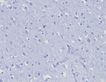 Negative control: IHC testing of FFPE human brain tissue with CD45RA antibody (clone PTPRC/8124R) at 2ug/ml. HIER: boil tissue sections in pH 9 10mM Tris with 1mM EDTA for 20 min and allow to cool before testing.