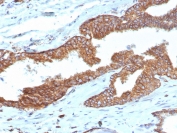 IHC staining of FFPE human prostate tissue with Cyclooxygenase 2 antibody (clone COX2/7803R). HIER: boil tissue sections in pH 9 10mM Tris with 1mM EDTA for 20 min and allow to cool before testing.
